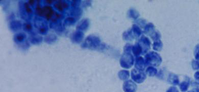 Blurry, blue cluster of round Candida albicans fungus.