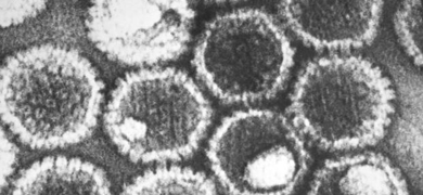 Gray, grainy, hexagon-shaped herpes simplex virus.