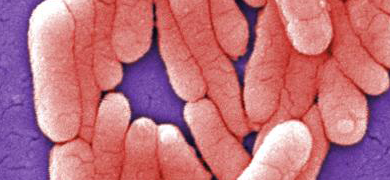 salmonella-typhimurium Pink, rod-shaped Staphyloccus epidermidis bacteria.