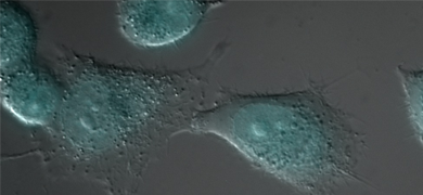Egf endocytosis in duodenal adenocarcinoma cell.