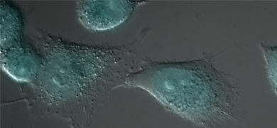 A549-cells-treated-with-anti-cancer-drug-AQ4 Egf endocytosis in duodenal adenocarcinoma cell.