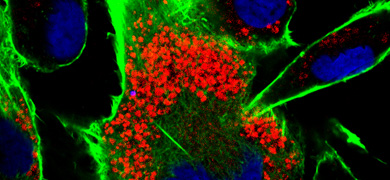 Green and red MDCK IFITM3 Phalloidin.