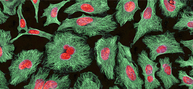 ATCC-CCL-2-HeLa-cells-1(1) BS Green red and pink HeLa cells.