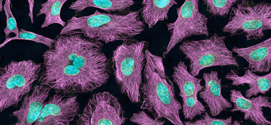 HeLa cells, purple, green and teal.