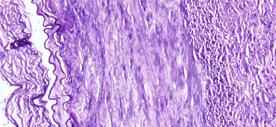 Purple elastic stain artery.