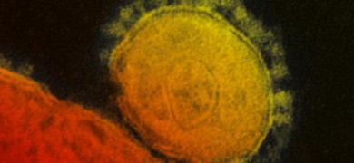 Middle East Respiratory Syndrome Coronavirus (MERS-CoV) fluorescent orange-yellow spheres with protrusions.