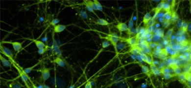 Green and blue neural progenitor cells.
