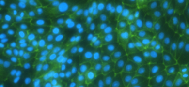 Connecting, fluorescent green strands and blue spheres of renal proximal tubular epithelial cells. 