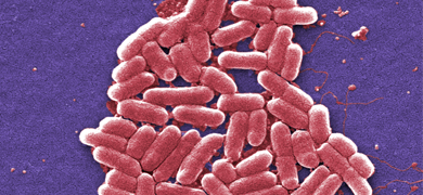 Pink rod-shaped  Escherichia coli bacteria clustered together.