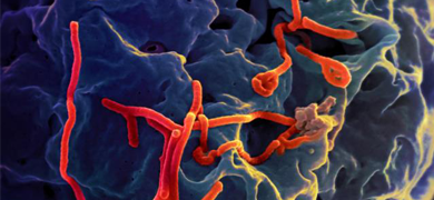 Long, thin, red, ebola rods stuck to a porous black-blue surface. 