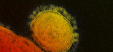Grainy, large red and yellow spheres of Middle East respiratory syndrome coronavirus.