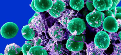 Green floating balls of Staphylococcus epidermidis bacteria tangled with purple tendrils.