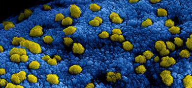 Blue and yellow Middle East respiratory syndrome coronavirus.