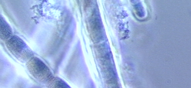 Long, skinny, pea-like rods of luminescent  Cyanobacteria.