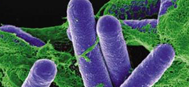 Long purple rods of Clostridium botulinum bacteria.
