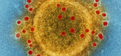 Grainy yellow sphere with red circles of the Middle East respiratory syndrome virus.
