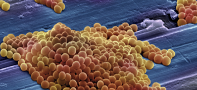 Cluster of round, yellow, and brown methicillin-resistant Staphylococcus aureus bacteria.