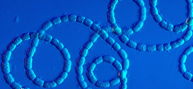 nostoc-cyanobacterium A blue string of small rod-shaped Nostoc cyanobacteria.
