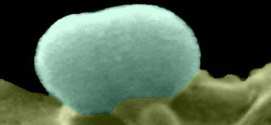 Grainy, light blue sphere of Eschirichia coli bacterium.