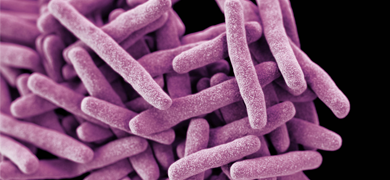 A cluster of long, thin, purple mycobacterium tuberculosis.