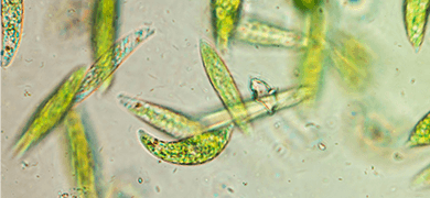 Bright green, translucent eukaryotic algal flagellates under a microscope.