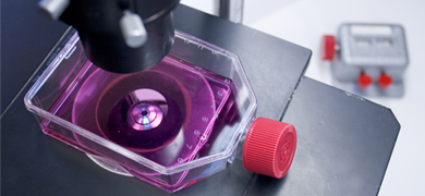 Culture flask containing purple media on stage of microscope.