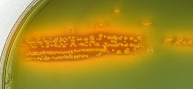 Petri dish culture of E coli bacteria.