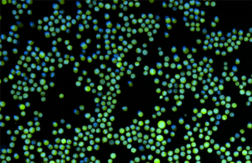 Green K562-GFP with nuclear stain.
