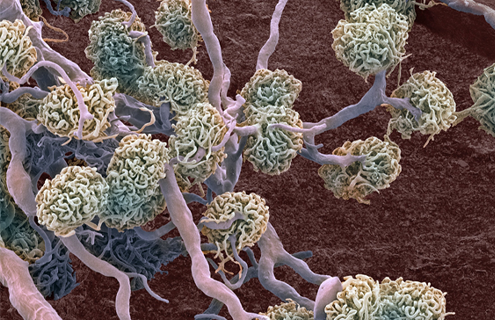 White, green and blue kidney glomeruli.