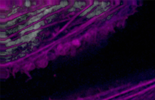 Purple and white human HeLa cancer cell cytokinesis.