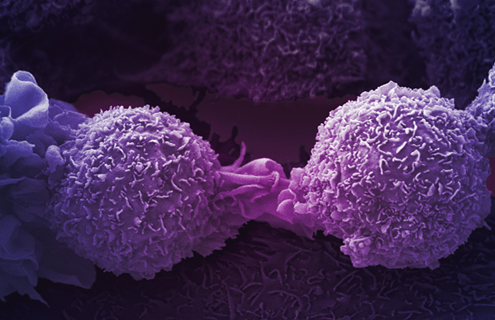 Purple lung cancer cells.