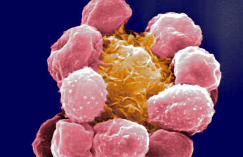 Pink and orange cluster of round, prune-like dendritic-cells.