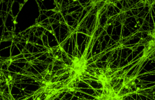 Green neural progenitor stem cells.