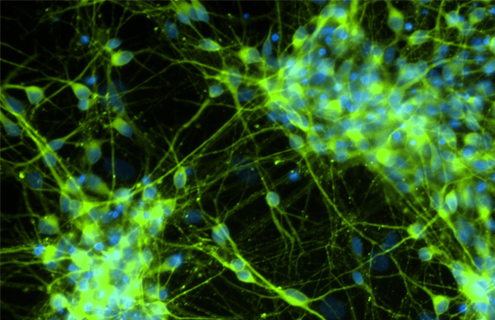 Green and blue dopaminergic neural progenitor cells