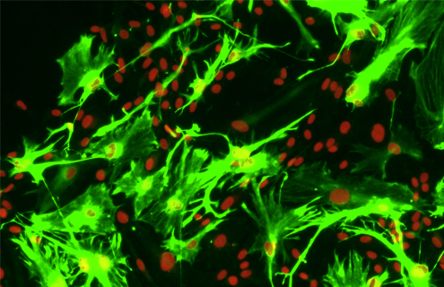 Green and red astrocyte GFAP neural progenitor cells.