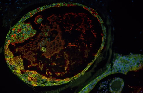 Green, red and blue organoid cells.