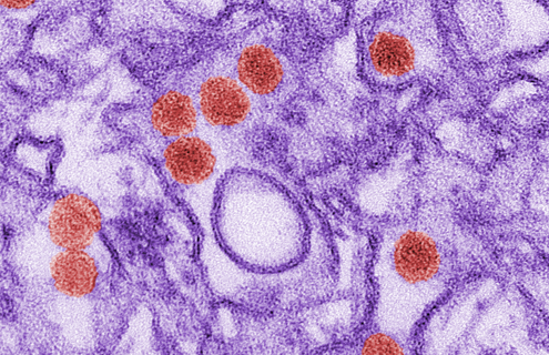 Purple and red TEM Zika virus cells.