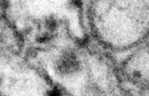 Gray dengue virus cells.