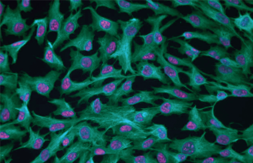 Green and purple Cyto-01 retinal epithelial cells.