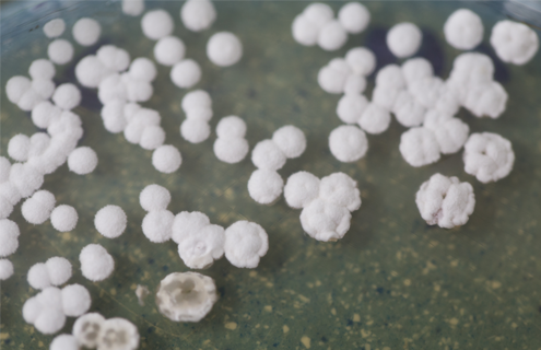Small, white, fluffy balls of bacteria.