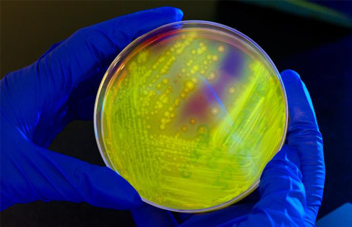 Blue-gloved hands holding a petri dish containing yellow clostridium difficile bacteria.