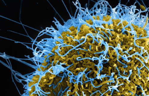 Tangled ball of blue and yellow ebola virus tendrils.