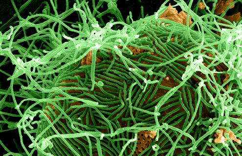 Tangled ball of long green and yellow ebola virus tendrils.