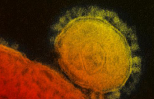 Grainy, large red and yellow spheres of Middle East respiratory syndrome coronavirus.