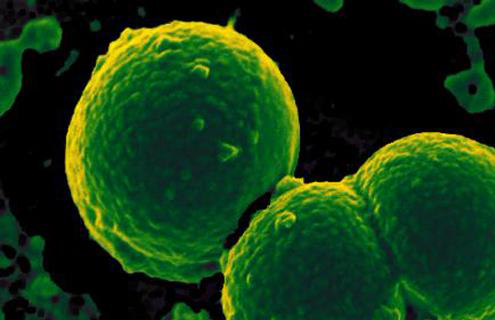 Cluster of round, green, textured, neutrophil-ingesting Methicillin-resistant Staphylococcus aureus.
