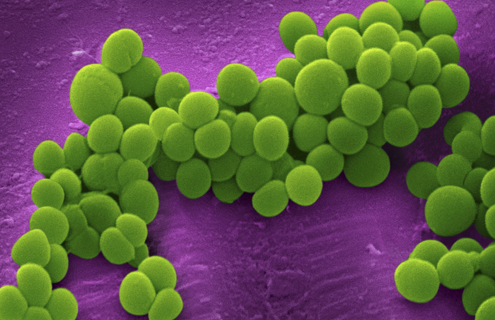 Cluster of green, grape-shaped methicillin-resistant Staphylococcus aureus bacteria.
