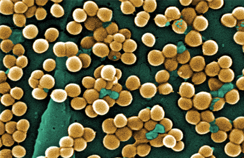 Small clusters of round, gold methicillin-resistant Staphylococcus aureus bacteria.