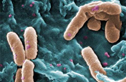 Brown, rod-shaped Pseudomonas aeruginosa bacteria.