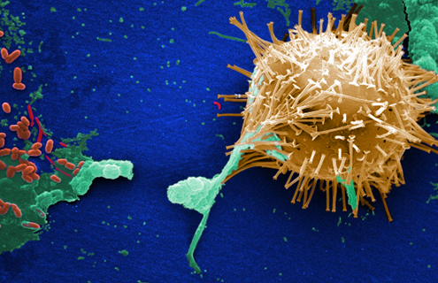Thin, green stem attached to a gold ball of spikes making up an untreated water specimen.