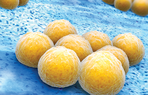 Yellow balls of Staphylococcus, aureus bacteria.